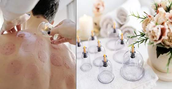 যে চিকিৎসা সবচেয়ে ভালো বলেছেন মহানবী