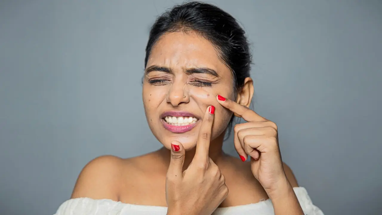মুখে ব্রণ থাকলে যে ভুলগুলো করবেন না