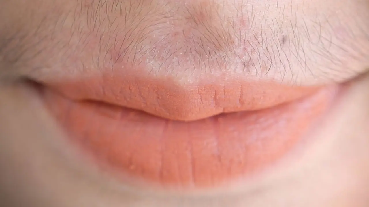 মুখের লোম দূর করার ঘরোয়া উপায়