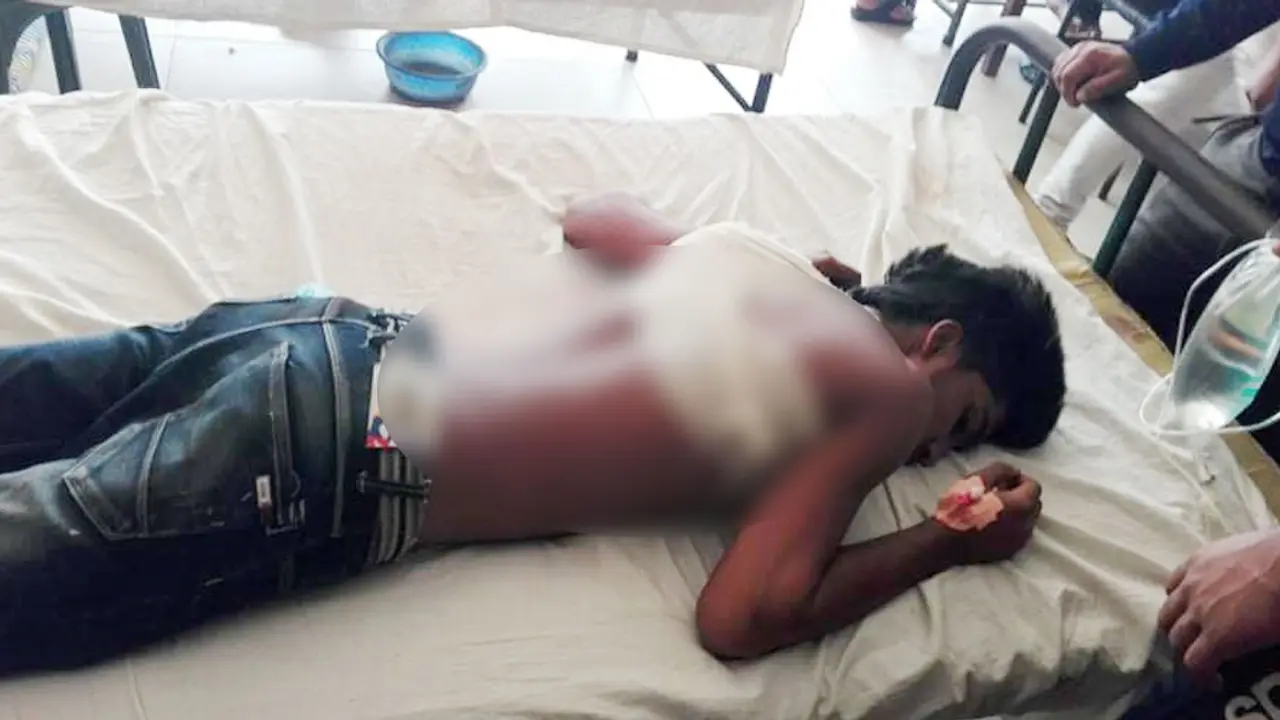যুবলীগের বর্ধিত সভায় ১০ জন ছুরিকাহত