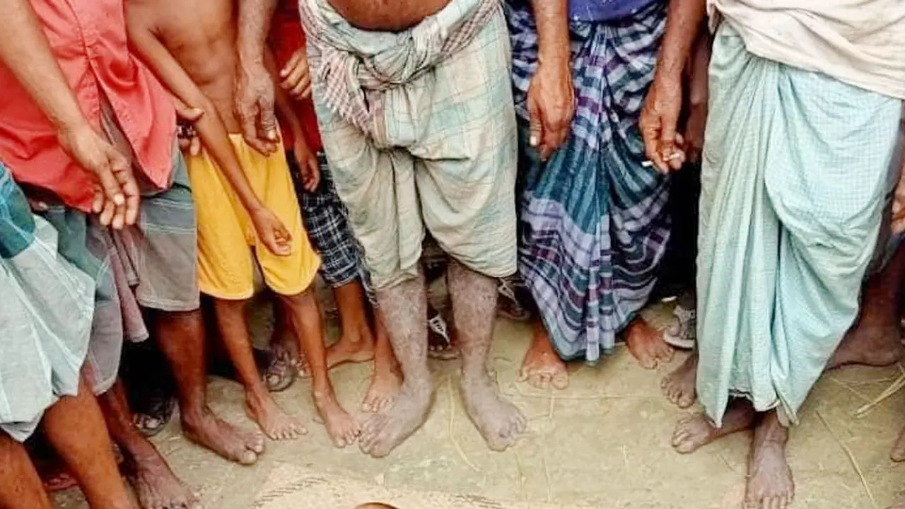 বিদ্যুতের তার ছিঁড়ে প্রাণ গেল একই পরিবারের ৩ জনের
