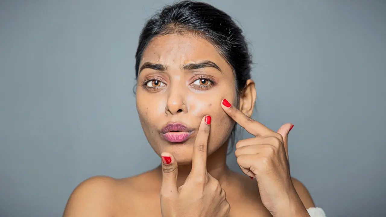 যেসব খাবার ব্রণ থেকে দূরে রাখবে