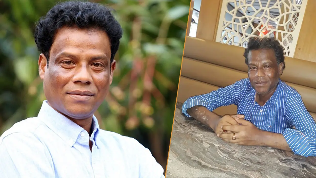 পায়ের অপারেশনের জন্য রক্ত খুঁজছেন গায়ক আকবর