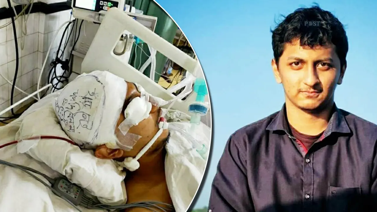 আকিবের খুলির হাড়ের অংশ প্রতিস্থাপন আজ