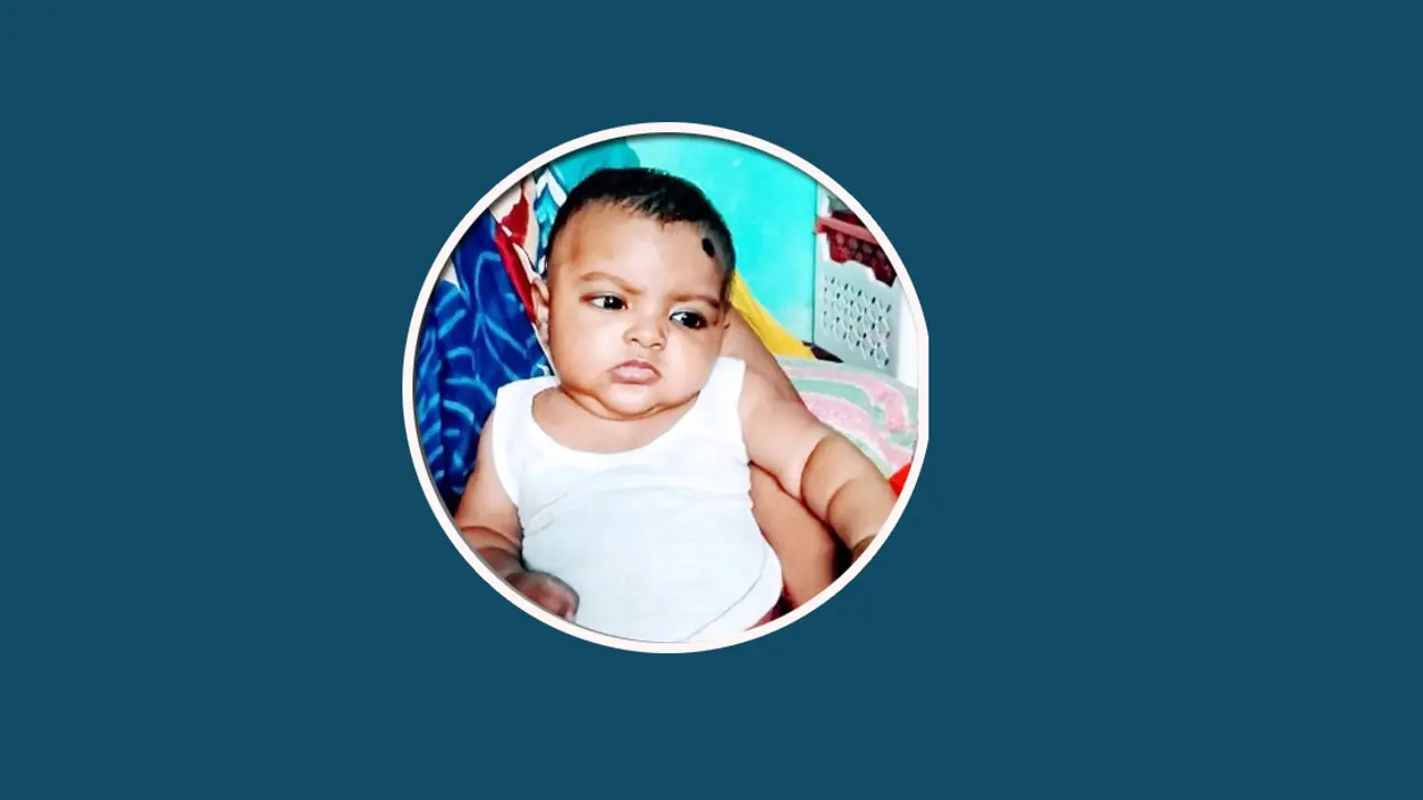 কান্না থামছে না অ্যাসিড দগ্ধ ৩ মাস বয়সী সূর্যের