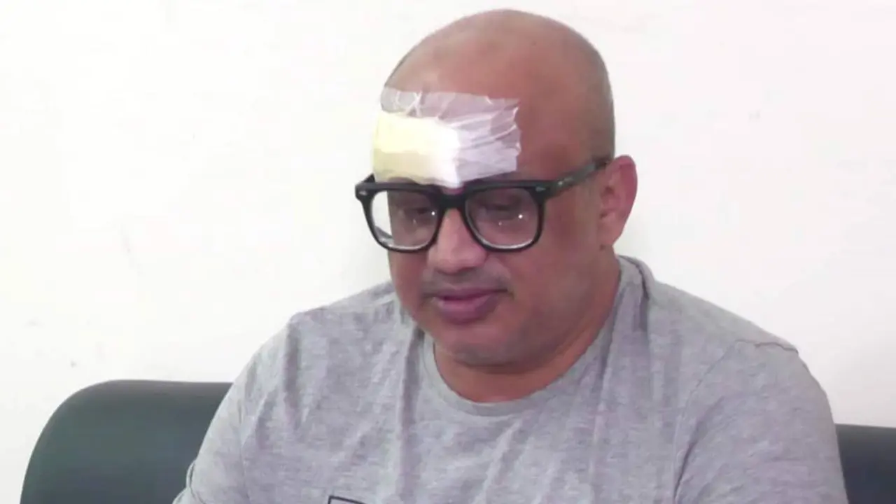 ডা. মুরাদের মাথার ওপর ভেঙে পড়ল সিলিং ফ্যান