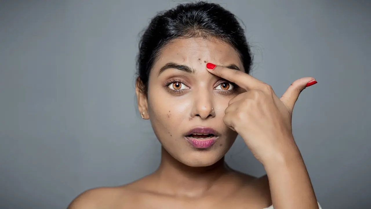 মুখের দাগ দূর করবে এই ৩ ফেসপ্যাক