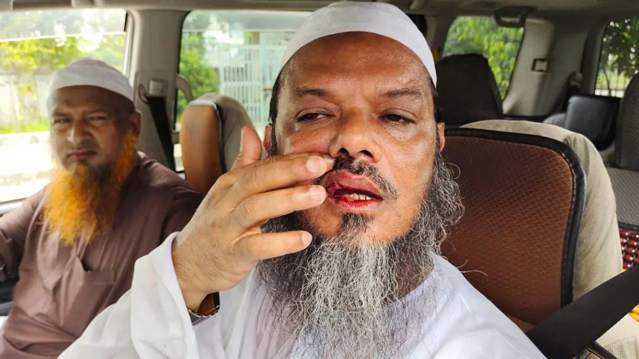 চরমোনাই পীরের ওপর হামলার নিন্দা রওশন এরশাদের