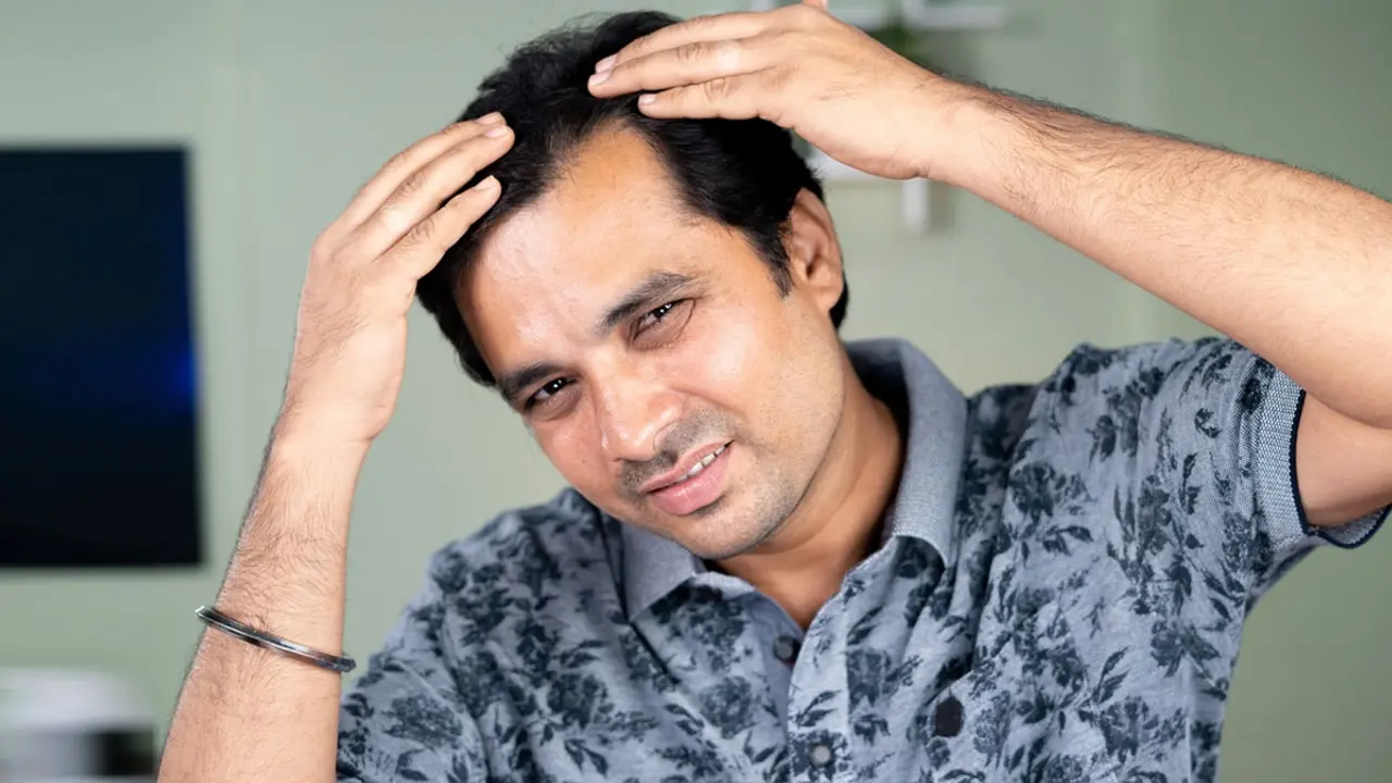 মাথায় টাক পড়ে যাচ্ছে? মেনে চলুন এই ৫ নিয়ম