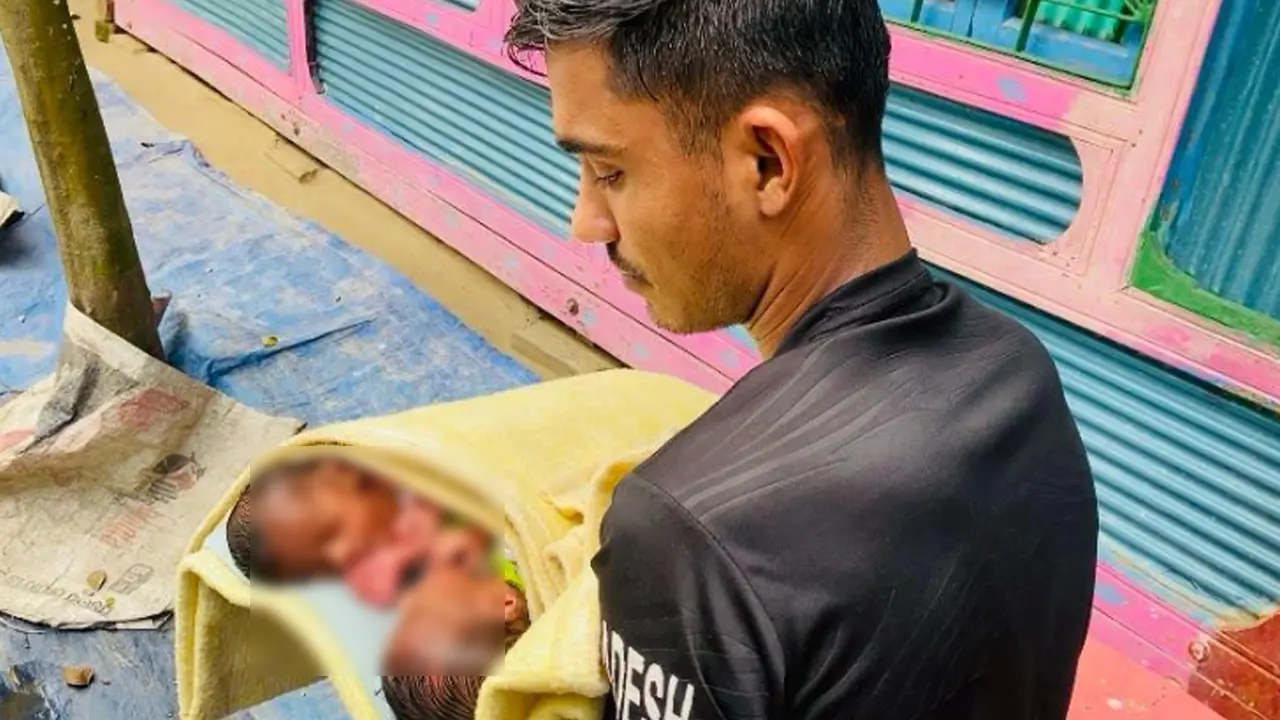পেট জোড়া লাগানো যমজ শিশু জন্ম নিয়ে দুশ্চিন্তায় দিনমজুর বাবা