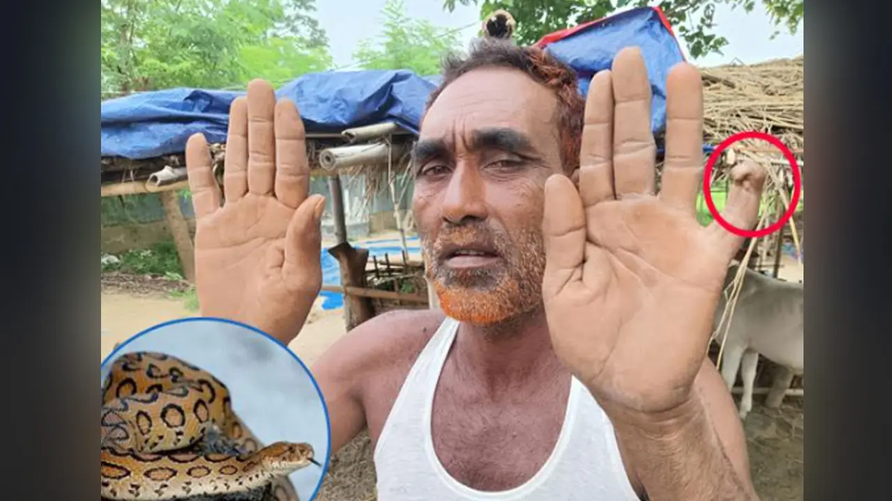 এক বছরেও ঠিক হয়নি আলমের আঙুলের ক্ষত