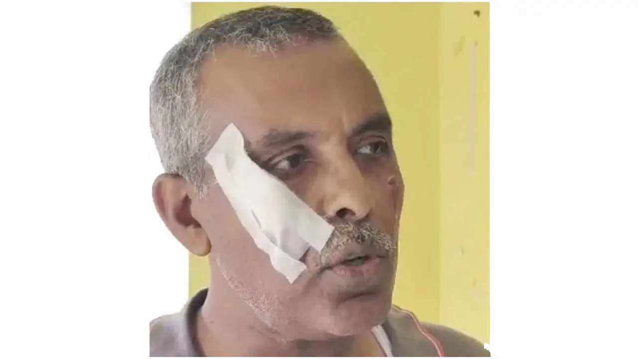 পিটিয়ে ডেপুটি ম্যাজিস্ট্রেটের মুখ ফাটিয়ে দিলেন দুই নিরাপত্তাকর্মী