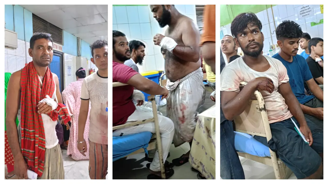 রাজধানীতে কোরবানি দিতে গিয়ে আহত ১৪০