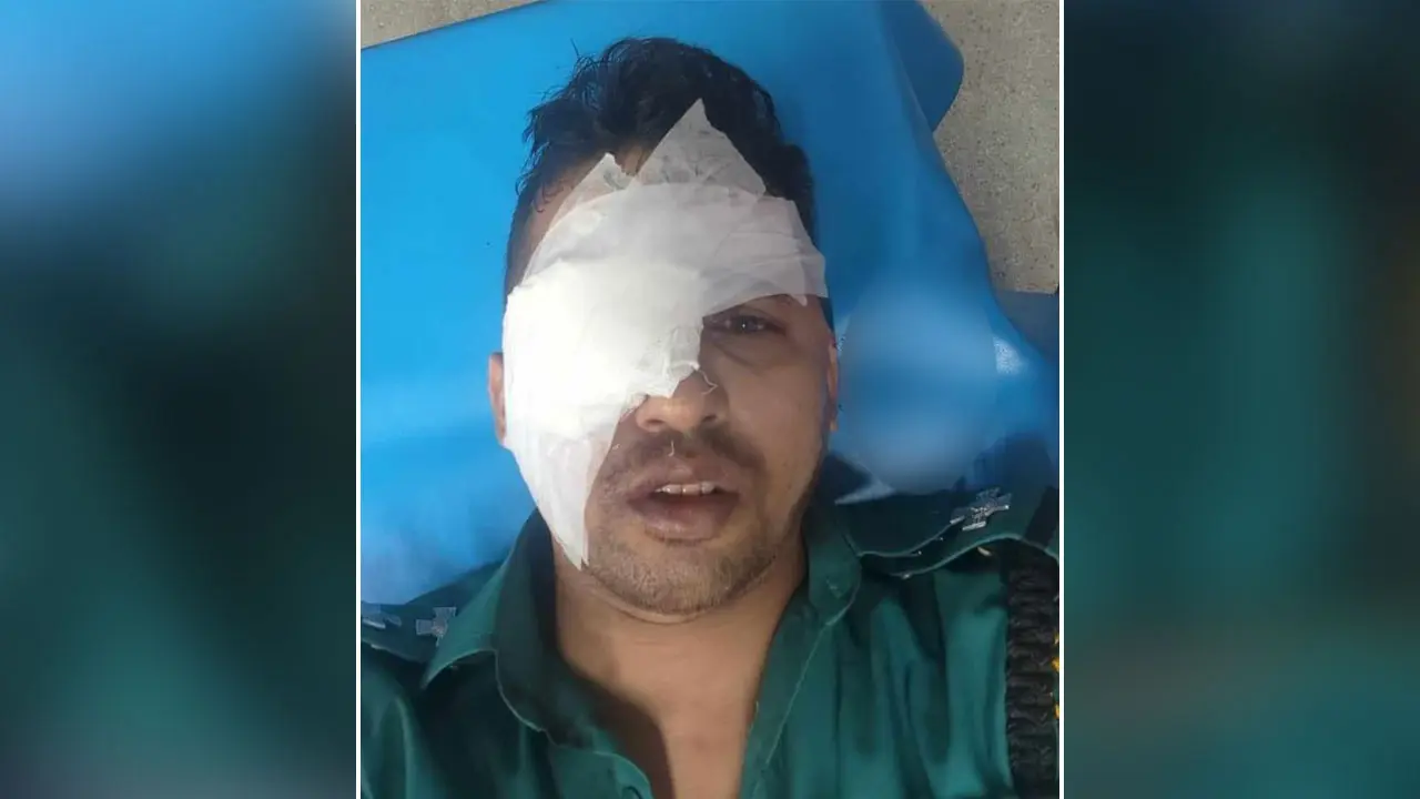 হিজড়াদের হামলায় চোখ হারাতে বসেছে এসআই