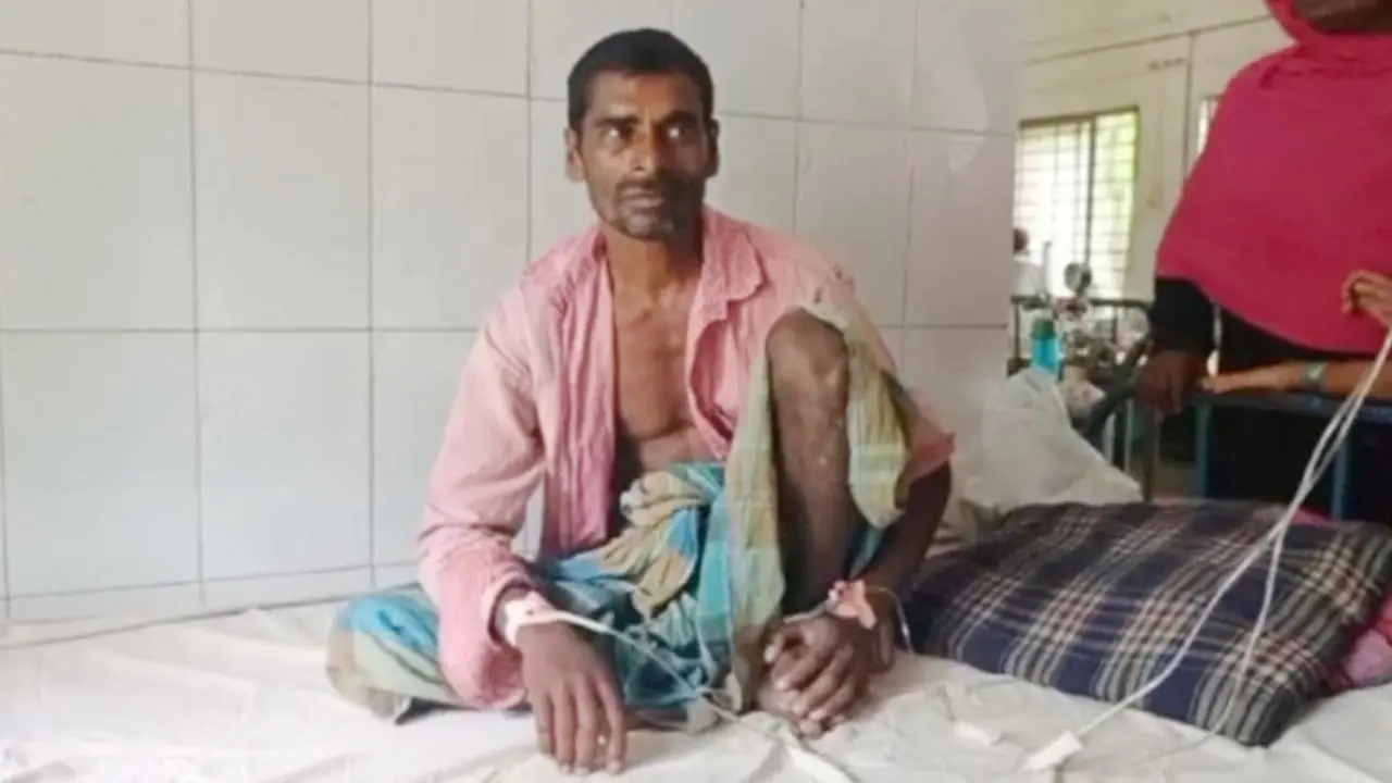 বাদাম তুলতে গিয়ে রাসেলস ভাইপারের দংশন, সাপ নিয়ে হাসপাতালে কৃষক