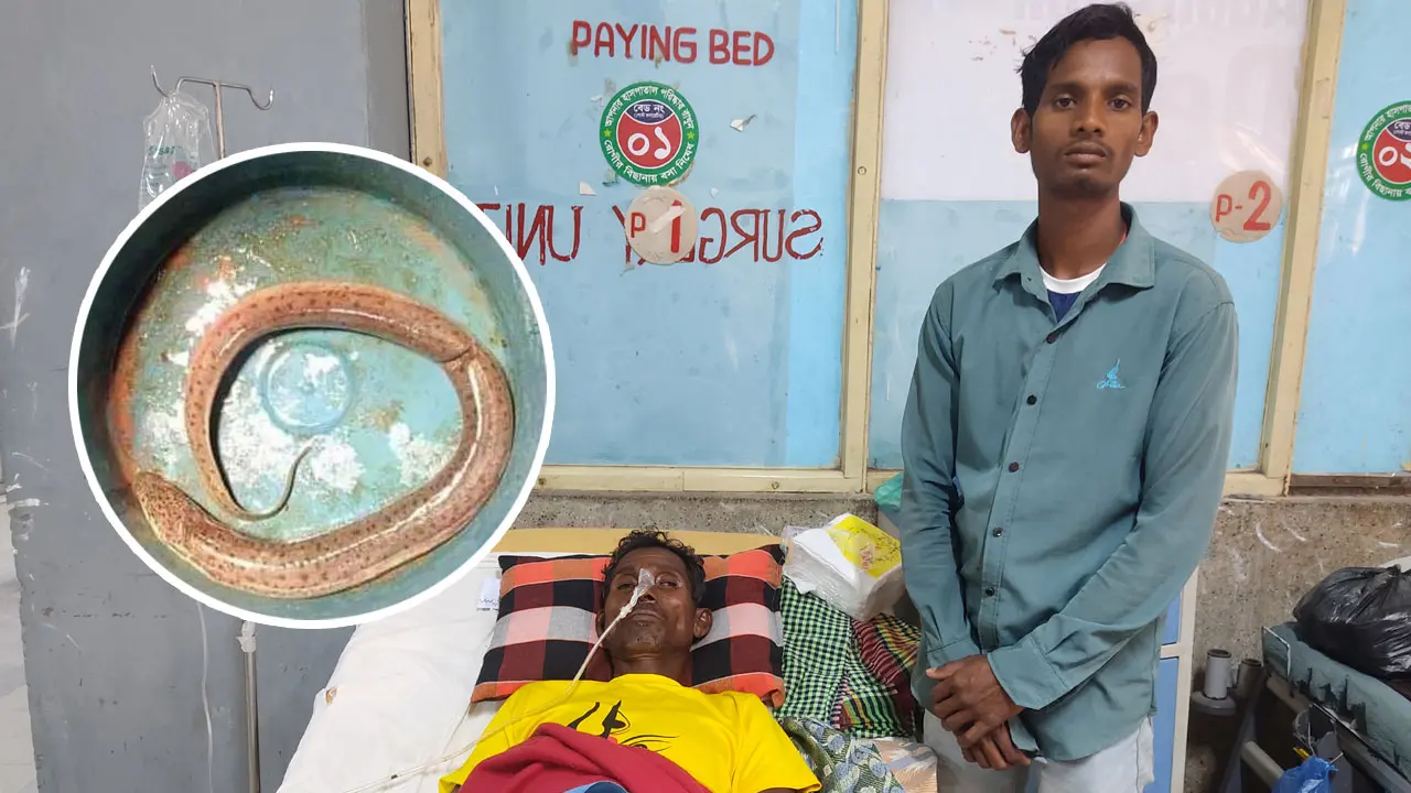 রোগীর পেট থেকে আস্ত কুঁচিয়া মাছ বের করলেন চিকিৎসকরা