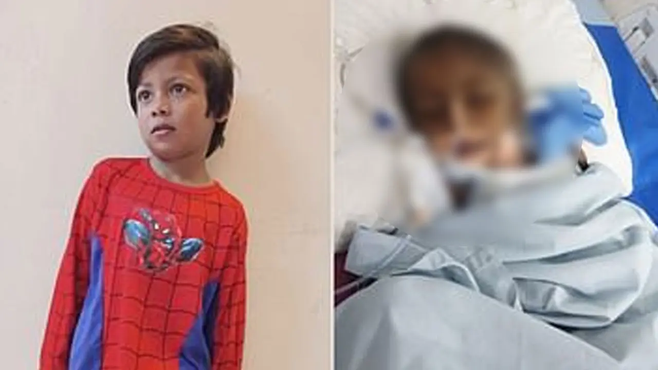 চোখ খুলে হাত-পা নাড়ছে গুলিবিদ্ধ সেই ছোট্ট মুসা