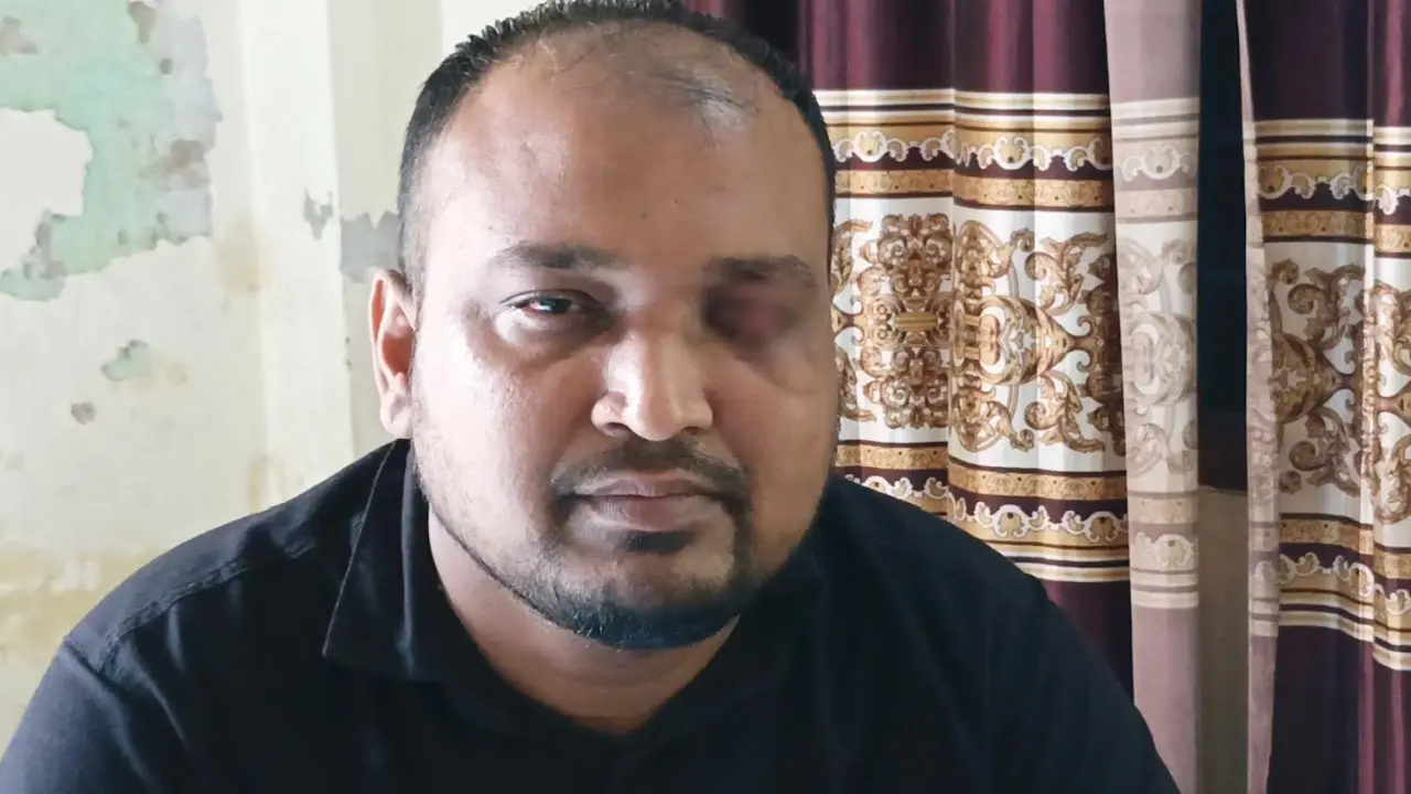 আন্দোলনে হারিয়েছেন চোখের আলো, দেখতে চান নতুন বাংলাদেশ