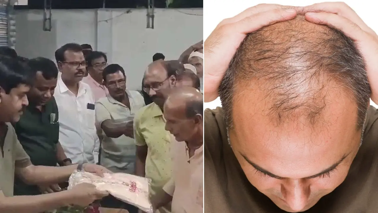 মাথায় টাক মানেই ‘বুদ্ধিমান-জ্ঞানী’, মিলল সংবর্ধনা!