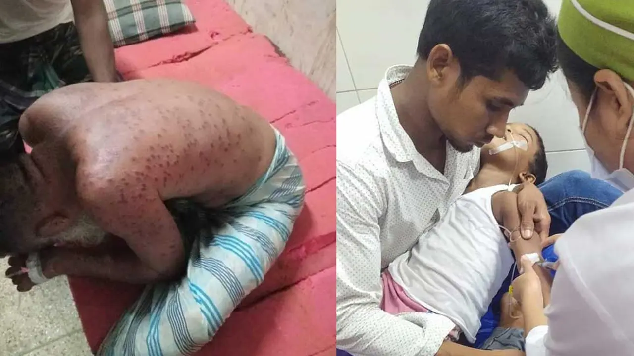 ভিমরুলের কামড়ে বাবা-মেয়ের পর মারা গেল ছেলেও