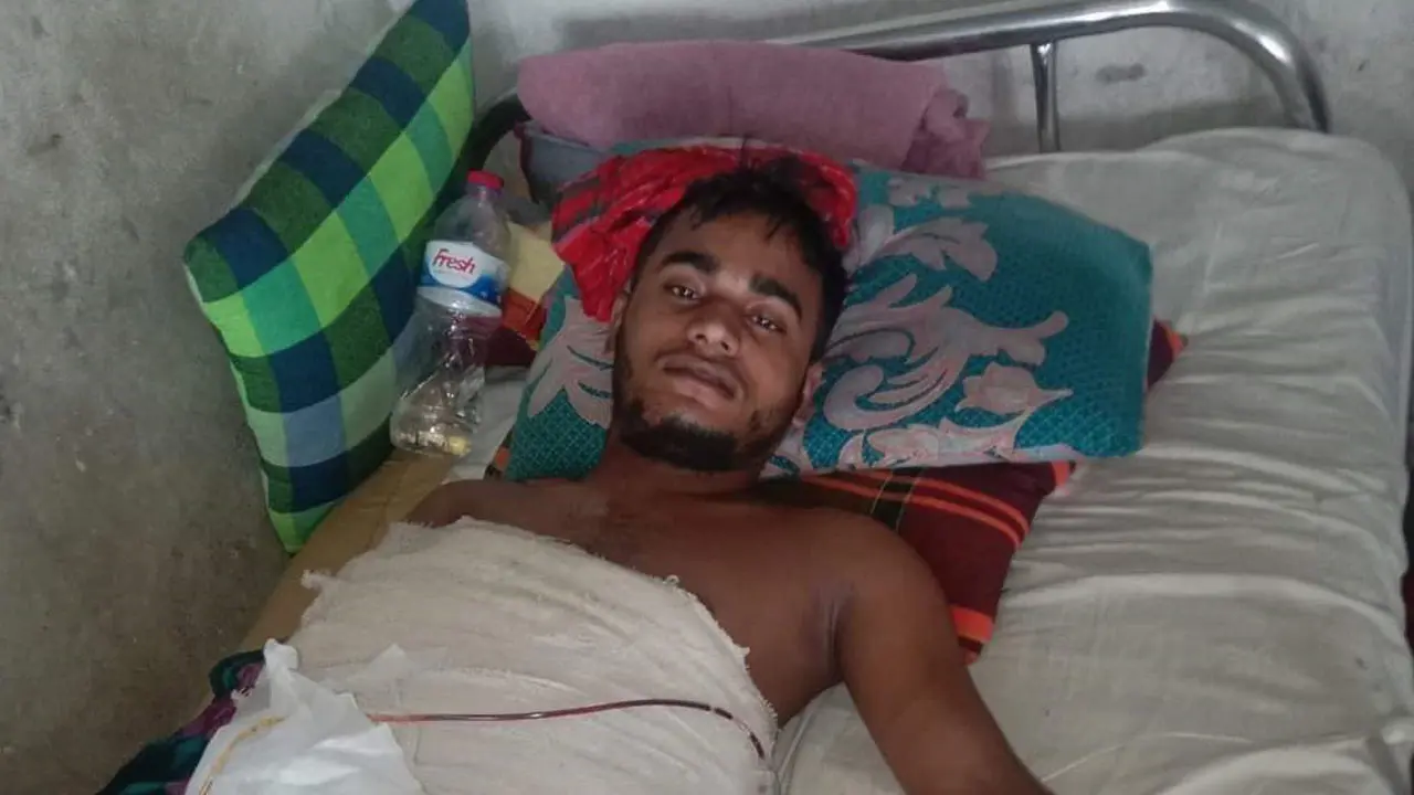 বৈষম্যবিরোধী আন্দোলনের দুই মাস পর আহত কারিমুলের মৃত্যু