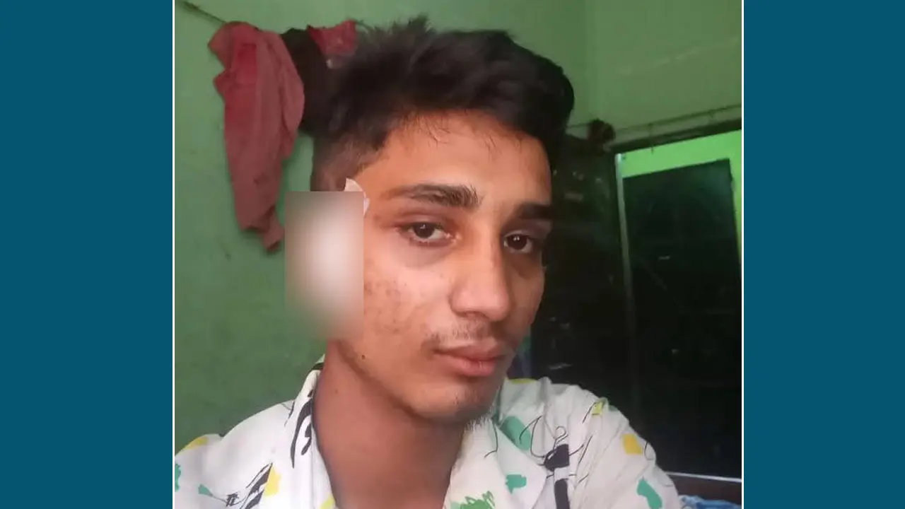 মাথায় গুলি নিয়ে চলে গেলেন জুলাই বিপ্লবের তরুণ যোদ্ধা ‘হৃদয়’