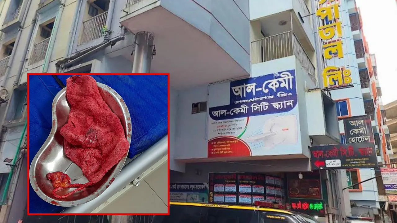 সিজারের ৭ মাস পর নারীর পেটে মিলল গজ কাপড়