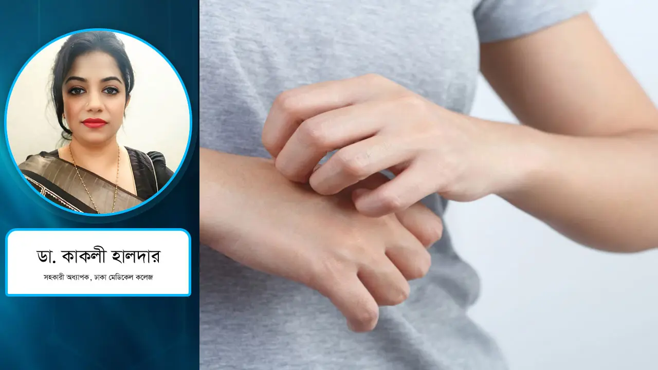 স্ক্যাবিস ও দাদ রোগী বাড়ছে কেন?