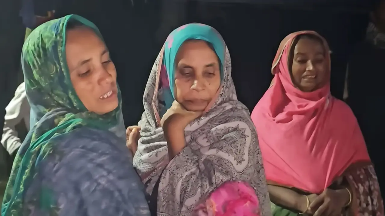 চাচার ঘর থেকে মায়ের কাছে ফিরছিল দুই বছরের শিশু, কামড়ে খেল শিয়াল