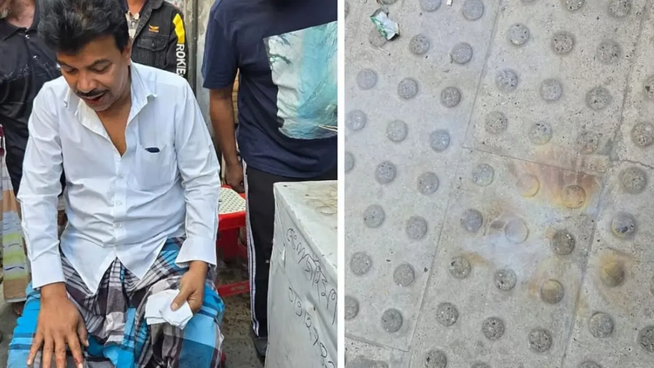 নিউ ইস্কাটন রোডে ককটেল বিস্ফোরণ, পথচারী আহত