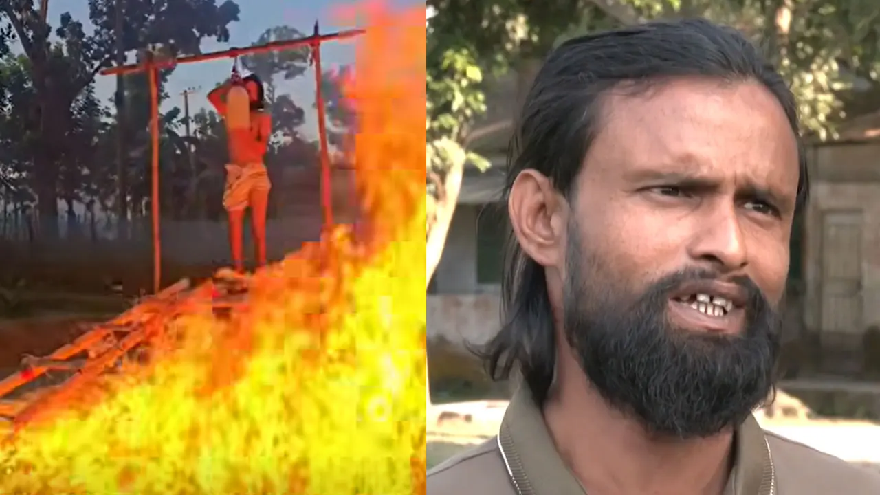 আগুন জ্বালিয়ে কন্টেন্ট তৈরি করতে গিয়ে আল-আমিন দগ্ধ