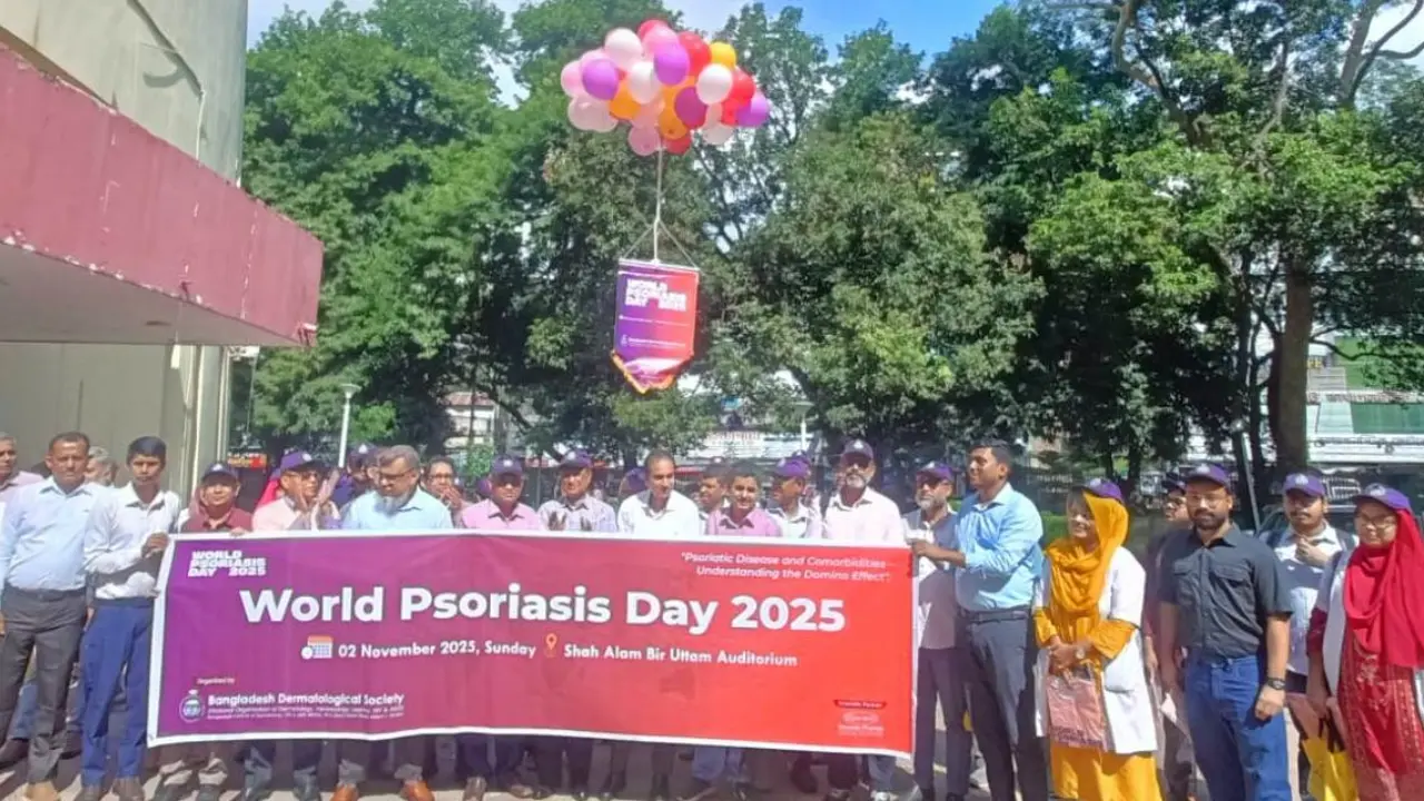 সোরিয়াসিস শুধু চর্মরোগ নয়, এটি রোগের সমাহার