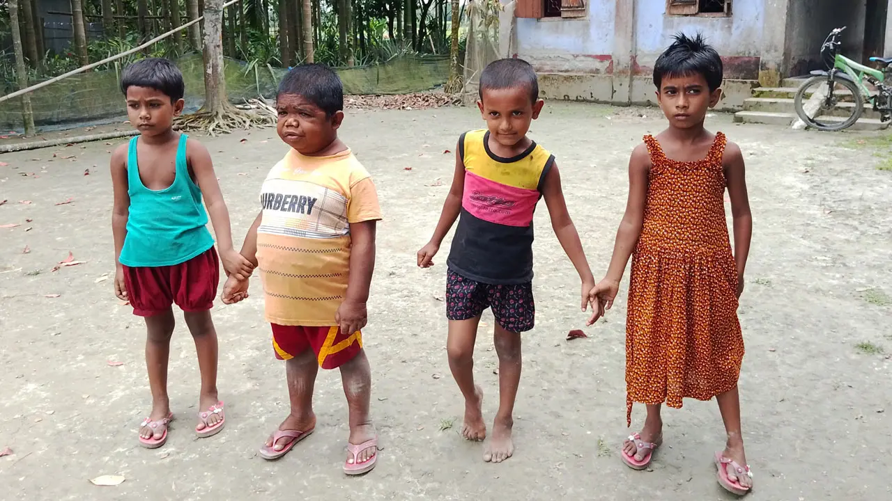 ৩৩ বছরেও শিশুই রয়ে গেছেন ছমির