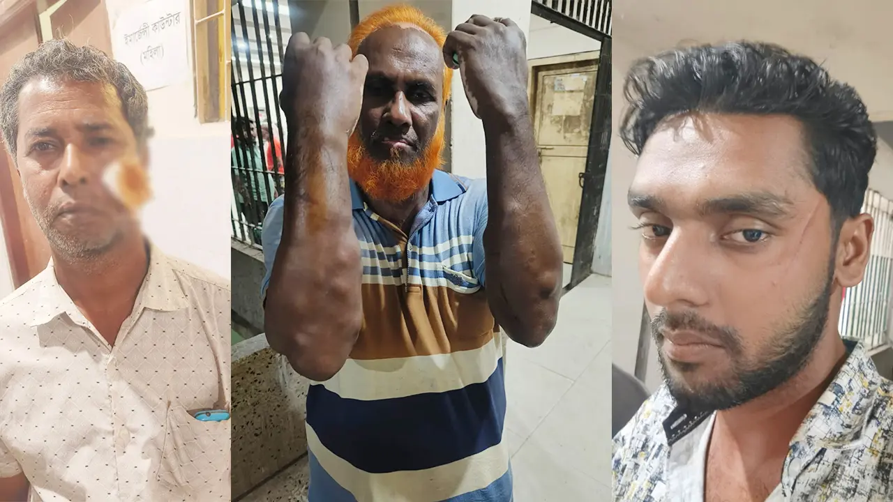 সাবেক উপজেলা চেয়ারম্যানসহ বিএনপির ৭ নেতা-কর্মী আহত