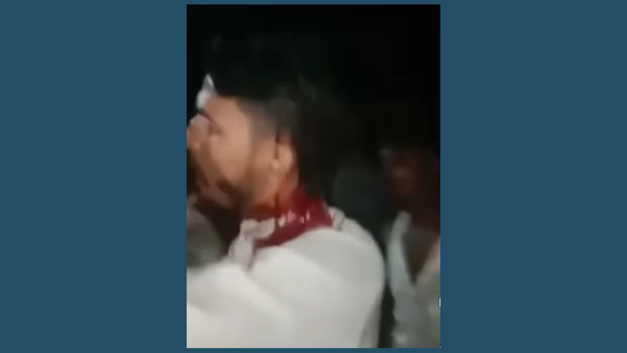 চট্টগ্রামে বিএনপি-জামায়াত সংঘর্ষ