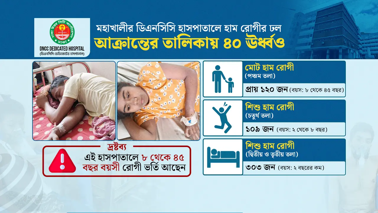 শিশুদের পাশাপাশি বড়রাও আক্রান্ত হচ্ছেন হামে
