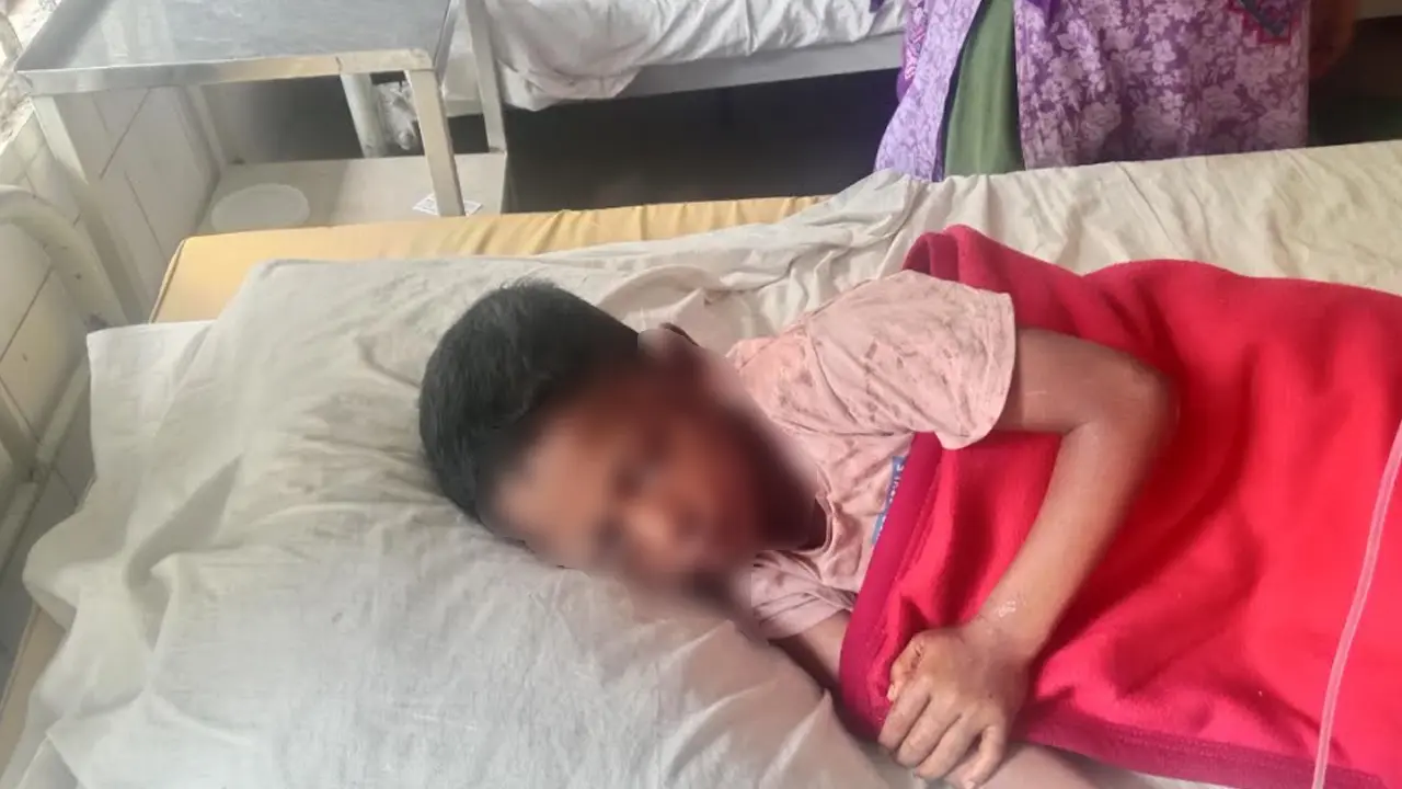 শিশুর দুই চোখে সুপার গ্লু ঢেলে দিয়েছেন দুলাভাই