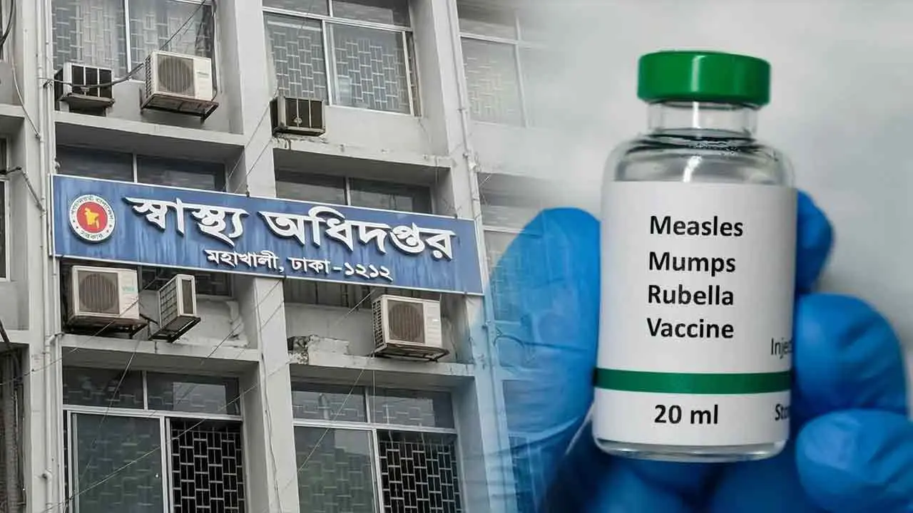 হামের উপসর্গে আরও ৮ মৃত্যু, প্রাণহানি ছাড়াল ৯০০