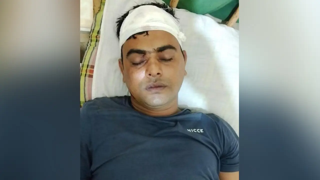 ডাকাত ধরতে গিয়ে হামলার শিকার ৩ পুলিশ সদস্য