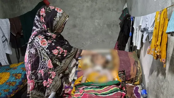 টাকার অভাবে জোড়া লাগছে না মাথার হাড়, বাঁচার আকুতি ৮ বছরের কলির