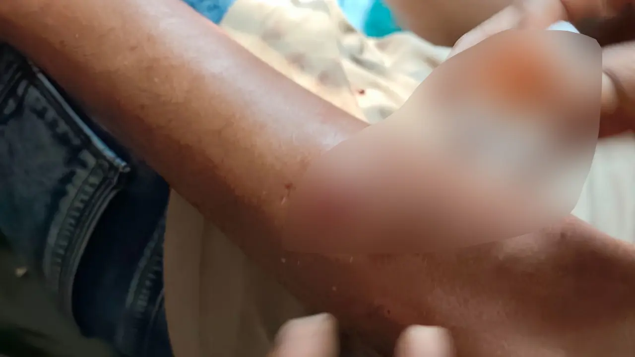 ফরিদপুরে যাত্রীবাহী বাস খাদে পড়ে আহত ১৭