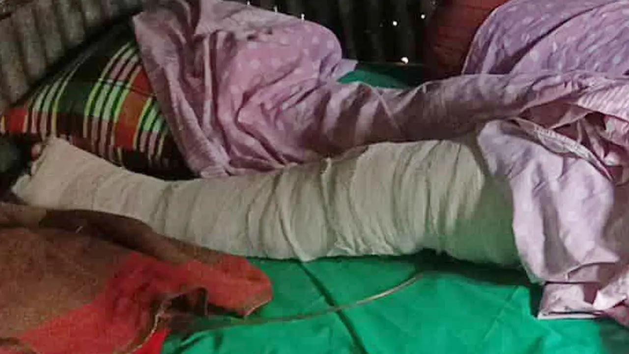 স্বামীর নির্যাতনে আগুন দিয়ে গৃহবধূর আত্মহত্যার চেষ্টা, ৯০ শতাংশ দগ্ধ