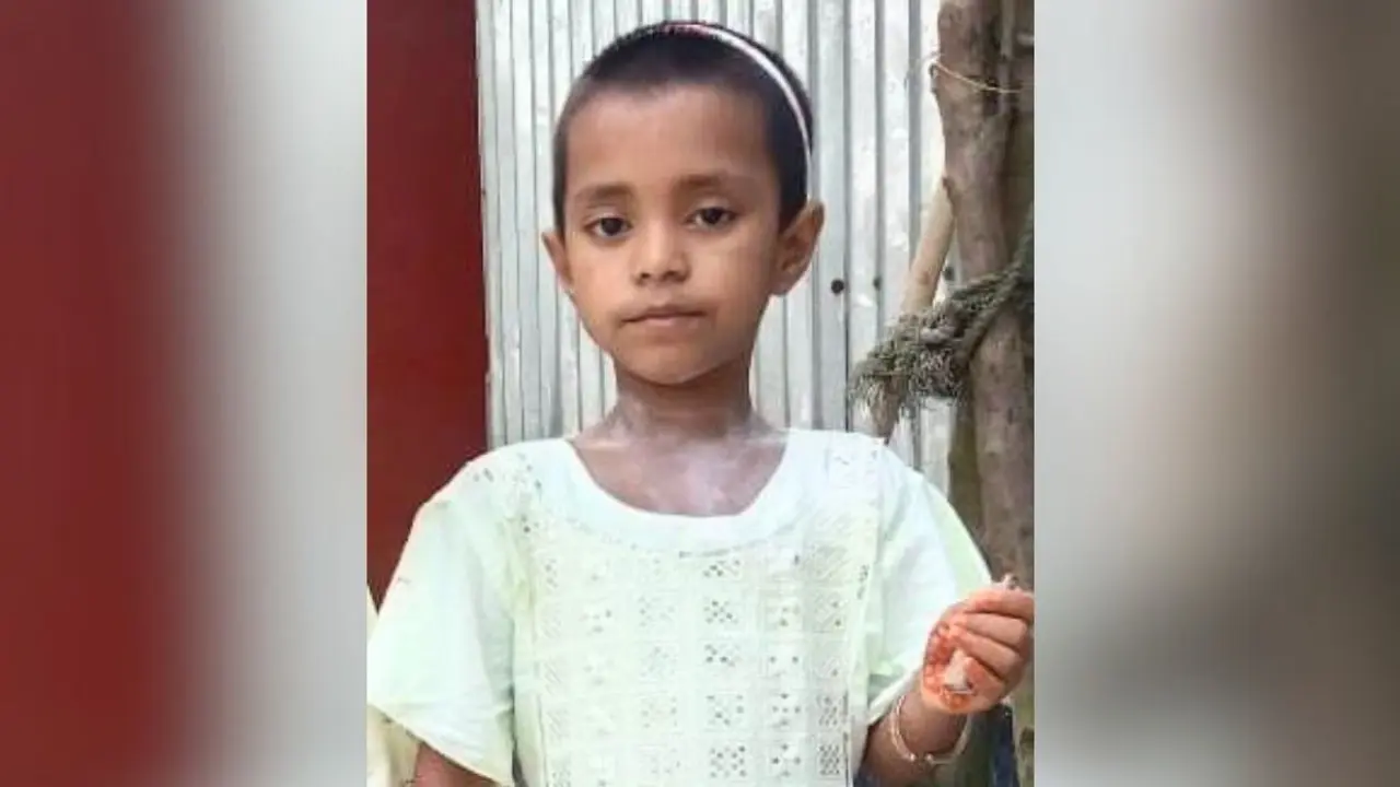 স্কুল থেকে বাড়ি ফেরার পথে অটোরিকশার ধাক্কায় শিশুশিক্ষার্থী নিহত