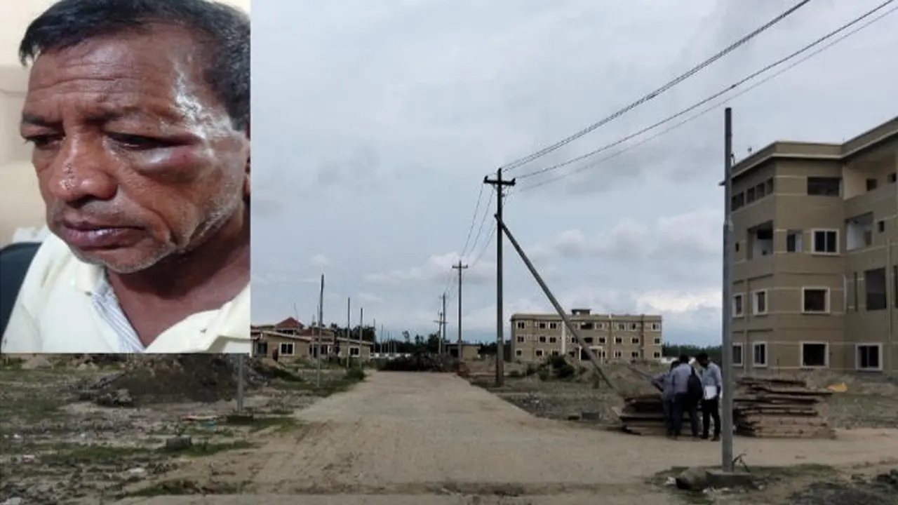চট্টগ্রামে সিকিউরিটি ইনচার্জের ওপর ঠিকাদারের কর্মীদের হামলার অভিযোগ