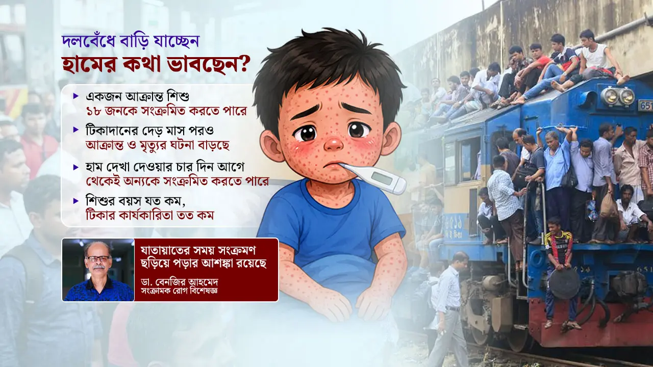 ঈদকে ঘিরে বাড়তে পারে হামের সংক্রমণ, কোনো নির্দেশনা নেই সরকারের