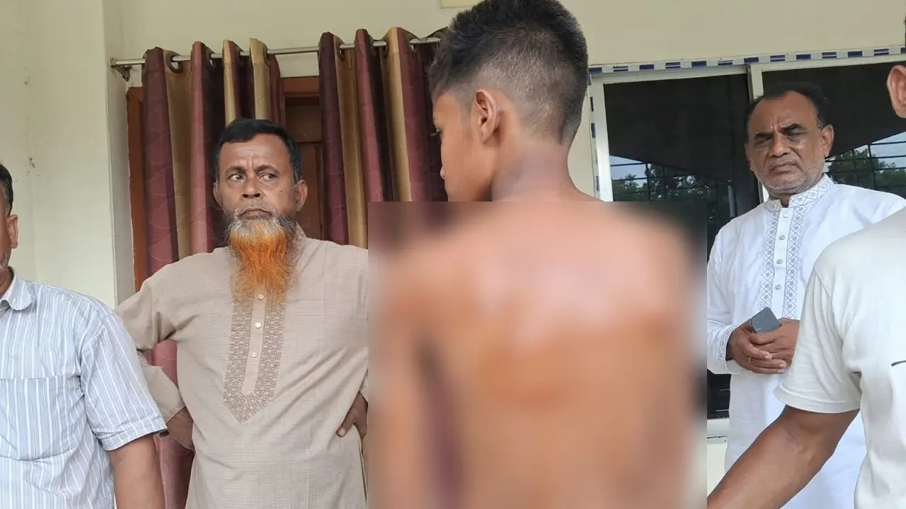 রাজবাড়ীতে শিক্ষকের বেত্রাঘাতে শিক্ষার্থী হাসপাতালে