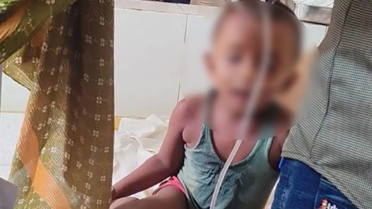 সাপের ছোবলে সংকটাপন্ন ৩ বছরের শিশু, চমেকের চিকিৎসায় উন্নতি