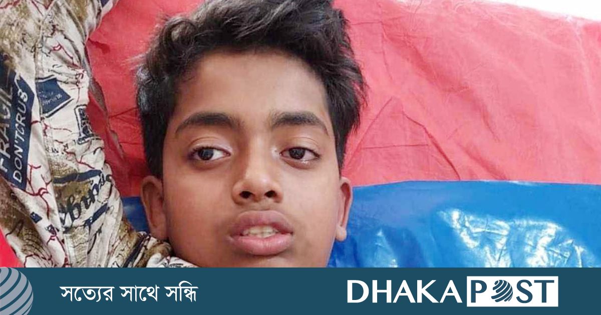 নিজের তৈরি আতশবাজি ফোটাতে গিয়ে দুটি আঙ্গুল বিচ্ছিন্ন