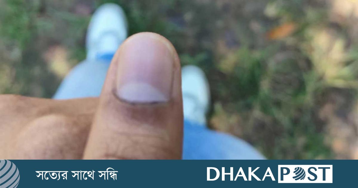 চাকসু নির্বাচন : মুছে যাচ্ছে কালি, অভিযোগ দেবে ছাত্রদল
